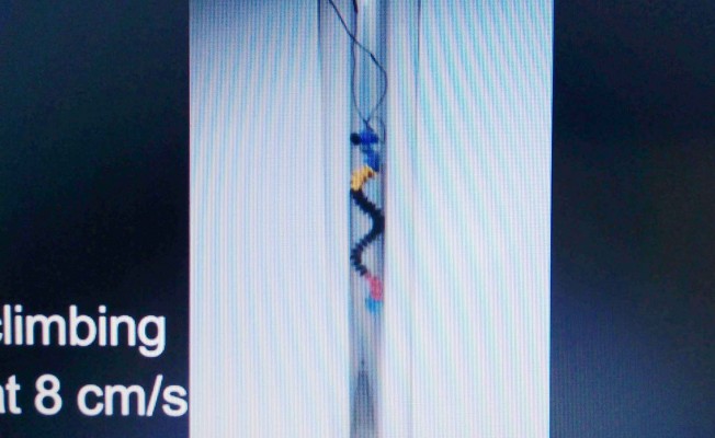 ‘Yutulabilir’ Robot Bağırsak Tedavisinde Kullanılmaya Hazırlanıyor